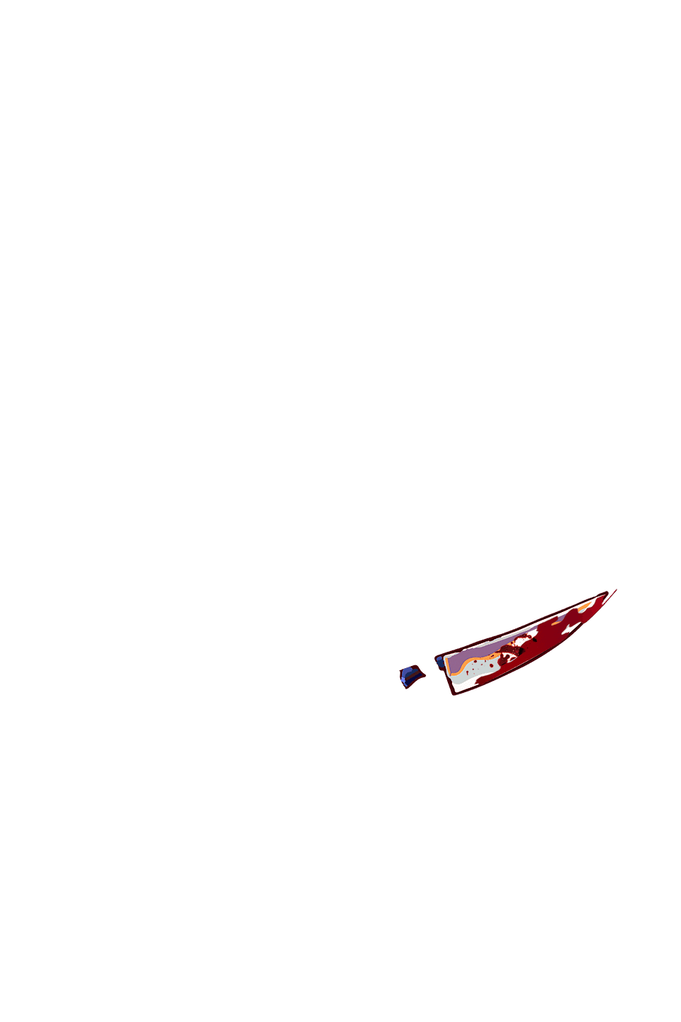Bloody Knife